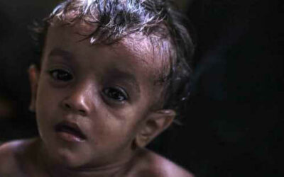Half a million children starving in Yemen